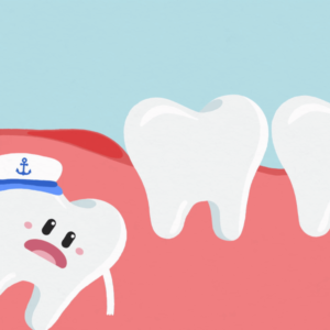 Everything You Should Know About Impacted Wisdom Tooth